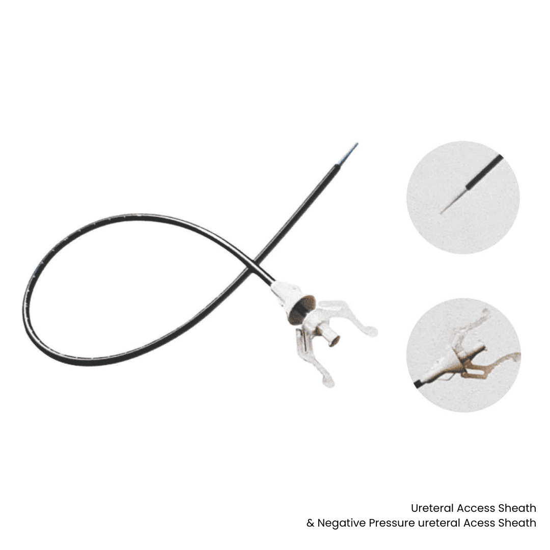 Ureteral Access Sheath & Negative Pressure ureteral Acess Sheath-urology series